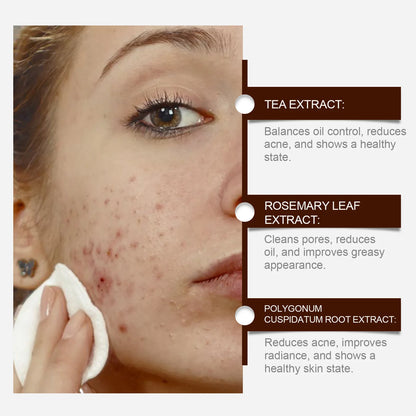 Pimple Acne Treatment Face Cream Oil Control Nourish Balance Refreshing Repairing Pimple Remover Acne Removing Cleansing Cream