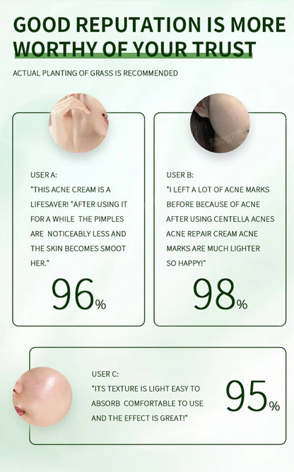 Anti-Acne Cream Effectively Removes Skin Nodules Pustules Cysts Papules Blackheads Men And Women Acne Skin Care Essence Cream