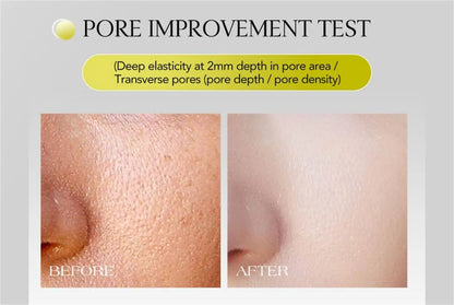 Retinol Anti-wrinkle Cream Collagen Anti-Aging Instant Removal Face Neck Wrinkle Efficient Moisturizing Firming Korean Skin Care