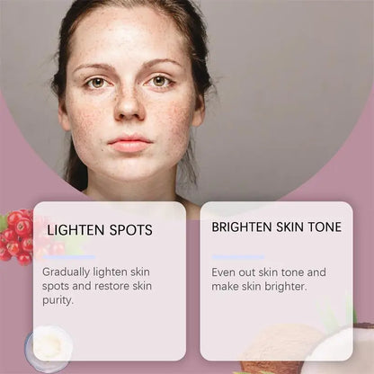 Powerful Spot-Removing Whiten Cream Brighten Skin Fast Eliminates Melanin Pigmentation Melasma Dark Spots Korean Skin Care